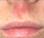Efek Samping Menumbuhkan Kumis Dengan Odol