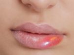 Ciri Bibir Tidak Cocok Dengan Lipstik